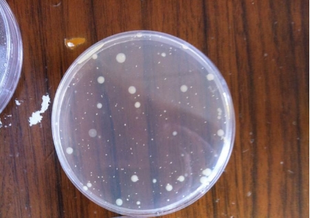 【行業干貨】從原理到實操：一文讀懂薄膜過濾法 vs 平皿法的適用邊界